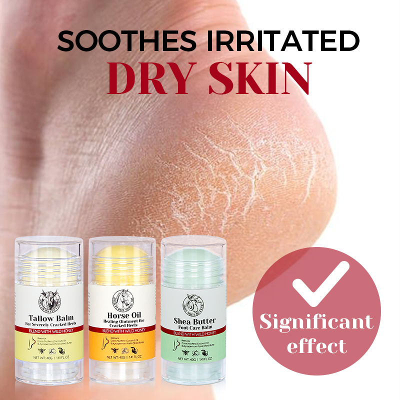 Beeswax Dead Skin Foot Callus Remover Foot Cream Care Stick Cracked Heel Repair Whipped Beef Tallow for Dry Feet - 10